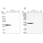 Anti-RPS3A Antibody