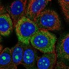 Immunofluorescent staining of human cell line MCF7 shows localization to nucleoli, cytosol & endoplasmic reticulum.