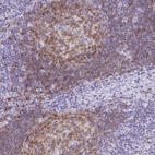 Anti-TAS2R39 Antibody