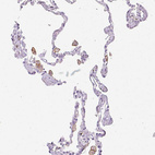 Anti-SIGLEC1 Antibody