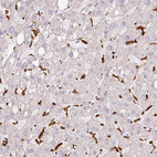 Anti-SIGLEC1 Antibody