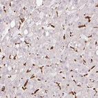 Immunohistochemical staining of human liver shows strong membranous positivity in Kupffer cells.