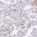 Immunohistochemical staining of human placenta shows strong membranous positivity in Hofbauer cells.