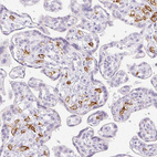 Anti-SIGLEC1 Antibody