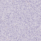Immunohistochemical staining of human pancreas shows no positivity in exocrine glandular cells as expected.
