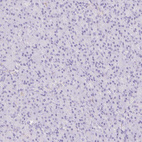 Anti-SIGLEC1 Antibody