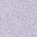 Immunohistochemical staining of human pancreas shows no positivity in exocrine glandular cells as expected.