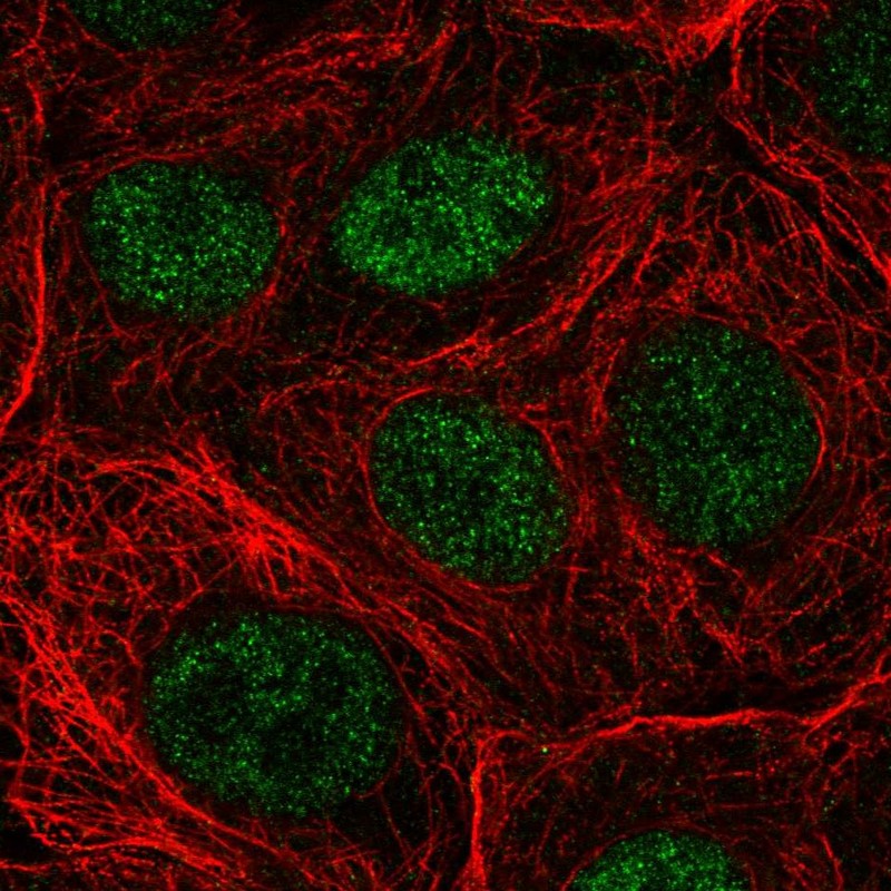 Anti-NUDT22 Antibody
