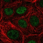 Anti-NUDT22 Antibody