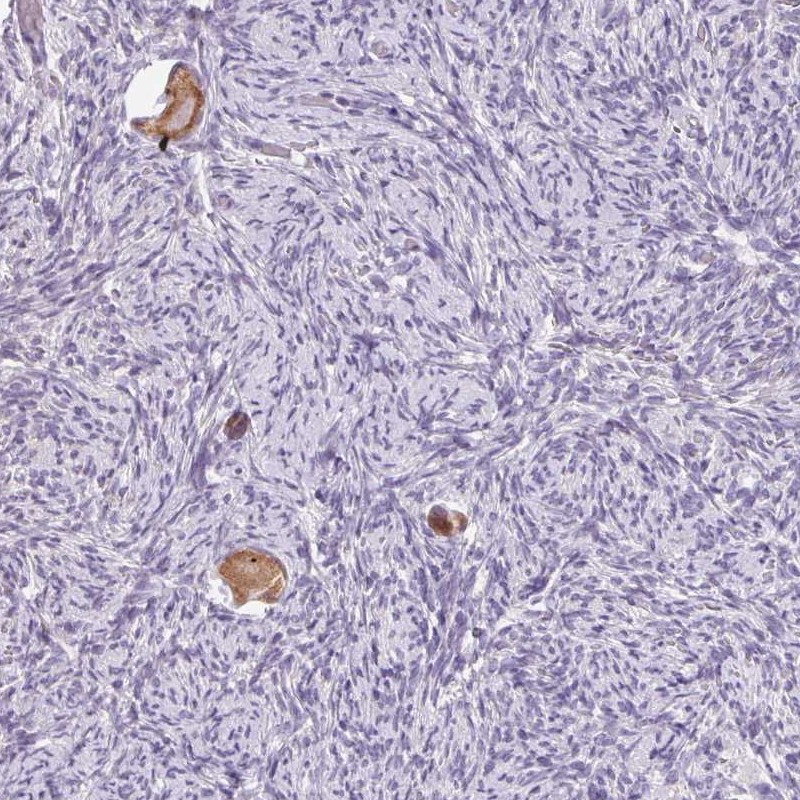 Anti-SNX31 Antibody