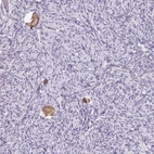 Anti-SNX31 Antibody