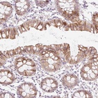 Anti-SPRYD4 Antibody