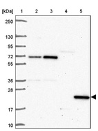 Lane 1: Marker [kDa] 250, 130, 95, 72, 55, 36, 28, 17, 10_br/_Lane 2: Human cell line RT-4_br/_Lane 3: Human cell line U-251MG sp_br/_Lane 4: Human plasma (IgG/HSA depleted)_br/_Lane 5: Human liver tissue