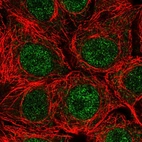 Immunofluorescent staining of human cell line MCF7 shows localization to nucleoplasm.