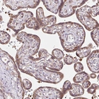 Immunohistochemical staining of human placenta shows moderate cytoplasmic positivity in trophoblastic cells.