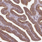 Immunohistochemical staining of human fallopian tube shows strong membranous positivity in glandular cells.