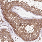 Immunohistochemical staining of human testis shows strong cytoplasmic positivity in cells in seminiferous ducts.