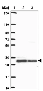 Lane 1: Marker [kDa] 250, 130, 95, 72, 55, 36, 28, 17, 10_br/_Lane 2: Human cell line RT-4_br/_Lane 3: Human cell line U-251 MG