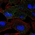 Immunofluorescent staining of human cell line A549 shows localization to vesicles.