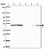 Lane 1: Marker [kDa] 250, 130, 95, 72, 55, 36, 28, 17, 10_br/_Lane 2: Human cell line RT-4_br/_Lane 3: Human cell line U-251MG sp_br/_Lane 4: Human plasma (IgG/HSA depleted)_br/_Lane 5: Human liver tissue_br/_Lane 6: Human tonsil tissue