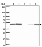 Lane 1: Marker [kDa] 250, 130, 95, 72, 55, 36, 28, 17, 10_br/_Lane 2: Human cell line RT-4_br/_Lane 3: Human cell line U-251MG sp_br/_Lane 4: Human plasma (IgG/HSA depleted)_br/_Lane 5: Human liver tissue_br/_Lane 6: Human tonsil tissue