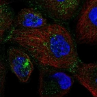Anti-SEC24D Antibody