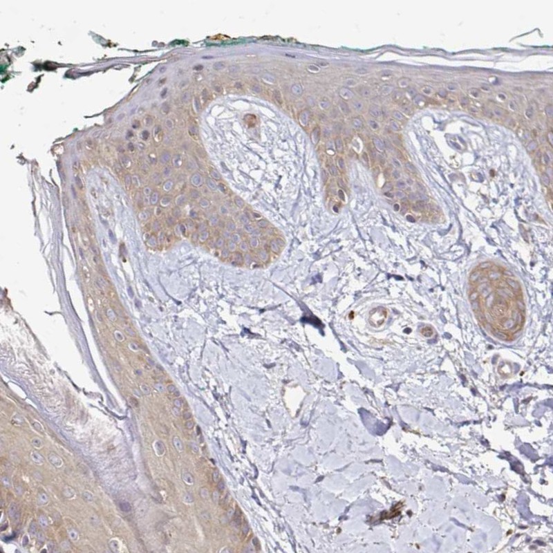 Anti-ARHGEF37 Antibody