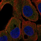 Immunofluorescent staining of human cell line HaCaT shows localization to cytosol.