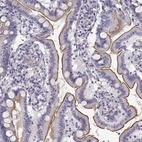 Anti-MYO1A Antibody