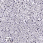 Anti-MYO1A Antibody