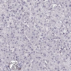 Immunohistochemical staining of human liver shows low expression as expected.