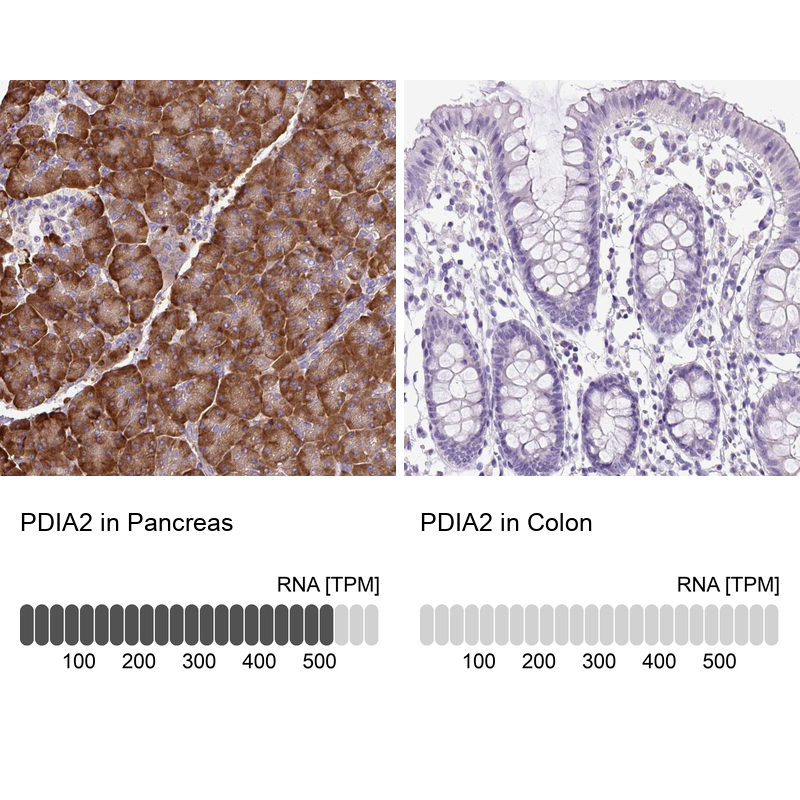 Anti-PDIA2 Antibody