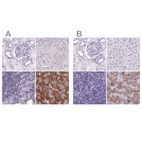Immunohistochemical staining of human kidney, liver, lymph node and pancreas using Anti-PDIA2 antibody HPA053492 (A) shows similar protein distribution across tissues to independent antibody HPA051692 (B).
