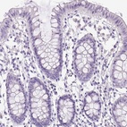 Immunohistochemical staining of human colon shows low expression as expected.