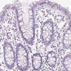 Immunohistochemical staining of human colon shows low expression as expected.