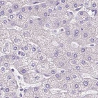 Immunohistochemical staining of human liver using Anti-PDIA2 antibody HPA053492.
