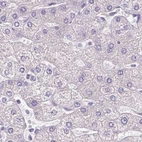 Immunohistochemical staining of human liver using Anti-PDIA2 antibody HPA053492.