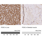 Anti-PCK2 Antibody