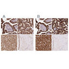 Anti-PCK2 Antibody