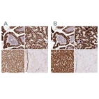 Immunohistochemical staining of human gastrointestinal, kidney, liver and skeletal muscle using Anti-PCK2 antibody HPA053502 (A) shows similar protein distribution across tissues to independent antibody HPA051162 (B).