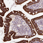 Anti-PCK2 Antibody