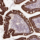 Immunohistochemical staining of human duodenum shows strong granular cytoplasmic positivity in glandular cells.