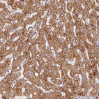 Anti-PCK2 Antibody