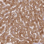 Immunohistochemical staining of human liver shows strong granular cytoplasmic positivity in hepatocytes.