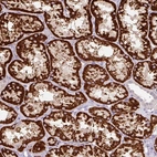 Immunohistochemical staining of human kidney shows strong granular cytoplasmic positivity in cells in tubules.