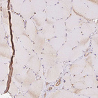 Immunohistochemical staining of human skeletal muscle shows no positivity in myocytes as expected.