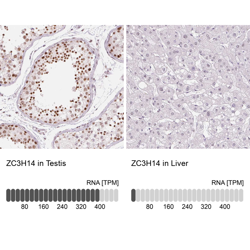 Anti-ZC3H14 Antibody
