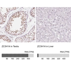 Anti-ZC3H14 Antibody