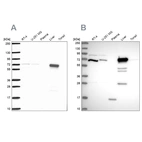 Western blot analysis using Anti-PCK2 antibody HPA053502 (A) shows similar pattern to independent antibody HPA051162 (B).