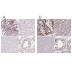 Immunohistochemical staining of human colon, kidney, liver and testis using Anti-ZC3H14 antibody HPA053510 (A) shows similar protein distribution across tissues to independent antibody HPA049798 (B).